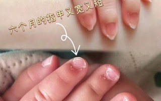 新生儿出生多久可以剪指甲