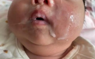 新生儿想吐奶却吐不出来，是消化问题还是身体异常信号？