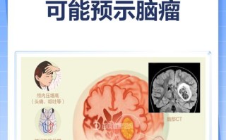 儿童脑瘤的发病诱因有哪些？遗传、环境还是其他未知因素在作祟？