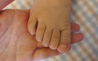 新生儿脚一直弯在那里是正常现象吗？需要干预吗？