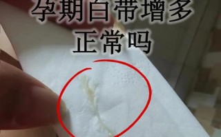 孕期无白带正常吗？