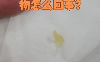 怀孕期间乳头出现脏东西是正常现象吗？需要特殊处理吗？