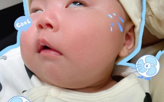 新生儿睡觉翻白眼是何原因？