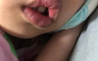 新生儿下嘴唇中间是凹