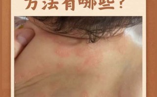 新生儿用红霉素安全吗？哪些情况需要用？有没有替代药？