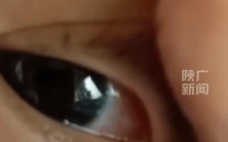 新生儿眼角白色分泌物是正常现象还是眼部疾病的信号？