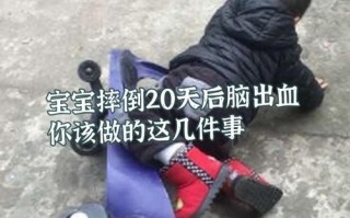 儿童颅内出血症状有哪些？