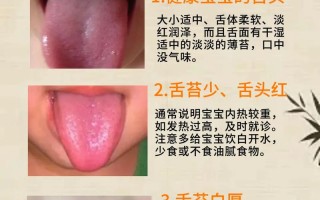 新生儿舌头发白是何原因？