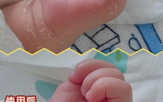 新生儿脸部皮肤娇嫩，到底该不该抹油？抹油会不会堵塞毛孔？抹什么油合适？