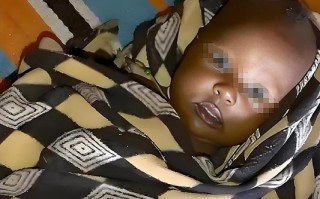 新生儿脸怎么越来越黑？是正常现象还是健康信号？需要干预吗？