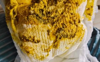 半个月新生儿拉肚子怎么办？需要马上就医还是先观察护理？