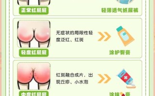 新生儿打屁多是消化不良还是正常生理现象？