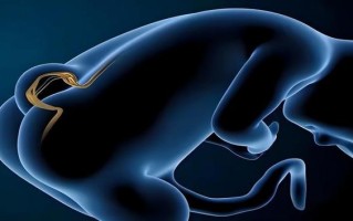 新生儿穿刺检查是否存在后遗症风险？后遗症类型及发生概率如何？