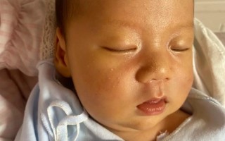两个月新生儿脸黄手白是正常生理现象还是健康异常信号？