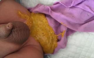 新生儿粑粑有泡泡是消化不良还是乳糖不耐受？新手爸妈该如何判断和处理？