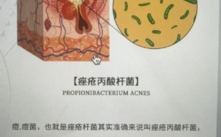 怀孕期间额头频长小痘痘，是激素波动还是营养失衡在作祟？