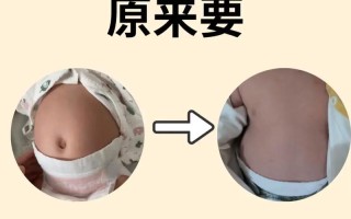 新生儿肚子胀气有哪些典型症状？