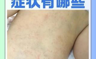 新生儿常见病有哪些？新手爸妈必知的健康预警信号与应对指南