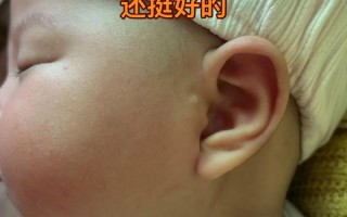 新生儿附耳形成是孕期发育异常导致的吗？与遗传或环境因素有关吗？