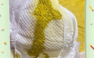 新生儿粑粑奶瓣和粘液