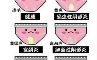 孕期患上滴虫性阴道炎，对胎儿有影响吗？该如何安全治疗？