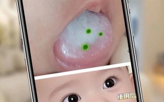 新生儿舌苔白厚正常吗