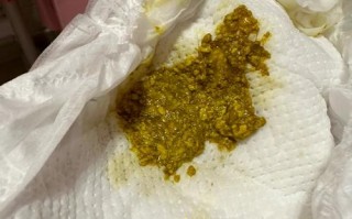 新生儿吃奶粉拉奶瓣正常吗？