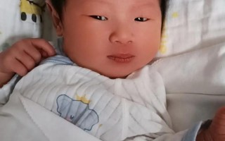 新生儿11天黄疸19mg/dl需要立即干预吗？母乳喂养会影响黄疸消退吗？