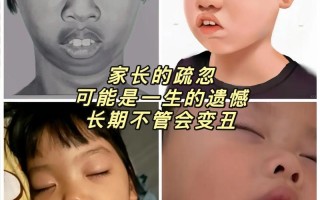 新生儿睡觉呼吸不畅是正常现象还是疾病信号？该如何正确处理与护理？