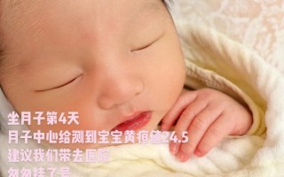 新生儿第四天黄疸240高吗？需要照蓝光治疗吗？对大脑有影响吗？