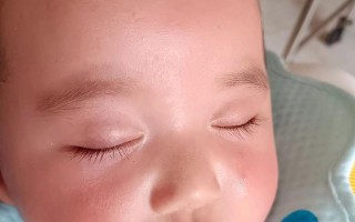 新生儿下巴抖动是正常现象吗？需警惕哪些问题？