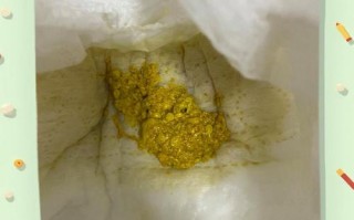 新生儿拉屎有奶瓣酸臭