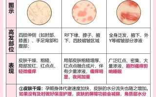 孕期身上发痒怎么办？
