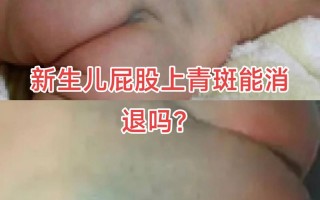 新生儿身上发青是怎么回事