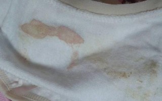 备孕期月经量突然变少，是怀孕信号还是身体出问题了？