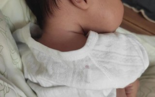 20天新生儿腿型弯曲是正常发育现象还是需要干预？