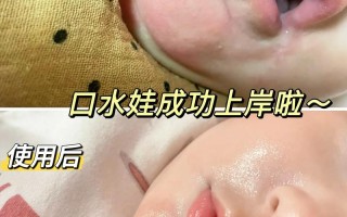 新生儿能用盐水洗嘴巴吗？