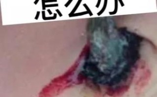 新生儿肚脐眼出血是何原因？