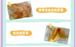 新生儿夜里频繁拉大便，是生理现象还是健康预警？