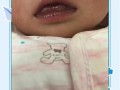 新生儿嘴周发青是缺氧还是其他问题？