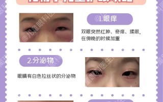 儿童眼睛浮肿是肾病信号？别忽视这些潜在健康风险！