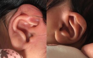 新生儿耳朵里会有胎脂吗？需要清理吗？对听力有影响吗？