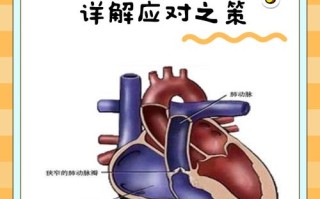 新生儿肺动脉重度狭窄有哪些症状及治疗方法？