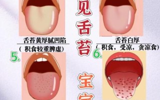 新生儿舌苔白是正常现象还是健康预警？需关注哪些潜在原因？
