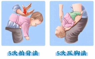 新生儿出现心绞痛症状该如何科学缓解，家长需掌握哪些关键应对措施？