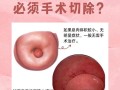 孕期发现子宫息肉，到底该不该手术？对胎儿有影响吗？