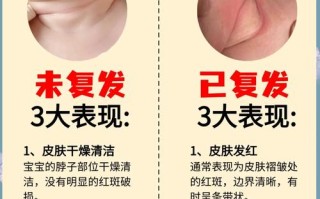 新生儿洗澡时淹破皮了，该怎么正确处理才能避免感染？