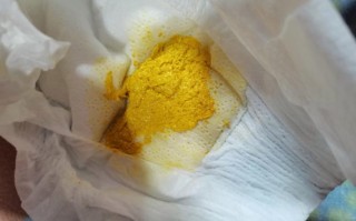 新生儿吃母乳拉黄水是正常现象还是消化问题？