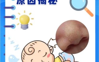 新生儿鼻子白点是啥原因？