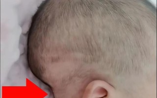 新生儿头骨软到底是不是缺钙的信号？需要怎么判断和应对呢？